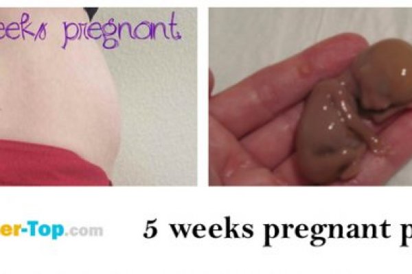 Сайты kraken арт пространство